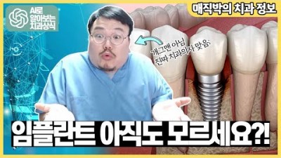 임플란트 정의 원리 수명 가격 비용 임플란트 수술 후 주의사항
