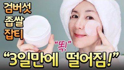피부관리 기미, 검버섯, 잡티, 사마귀, 여드름, 편평사마귀, 피부과 안가고 없애는 방법, 알로에수딩젤을 이용한 식초팩 방법