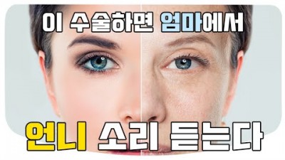 하안검, 상안검, 지방재배치 수술 비용 가격 정보, 상안검 수술과 쌍꺼풀 수술의 차이점, 중년성형 눈밑지방재배치 수술